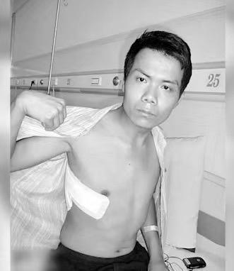 张海超在经历了16年的开胸验肺手术后，提及往事时不禁泪流满面，然而，积极面对生活并好好活着，依旧是他不可推卸的责任。-阿旺资源分享网