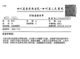 某医院误将患者CT影像资料弄混，导致一位女性患者被错误诊断为患有“绝症”，并连续服用药物三个月。-阿旺资源分享网