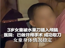 三岁女童头部被水果刀刺伤，紧急开颅取出刀具，现无生命危险，状况稳定。-阿旺资源分享网