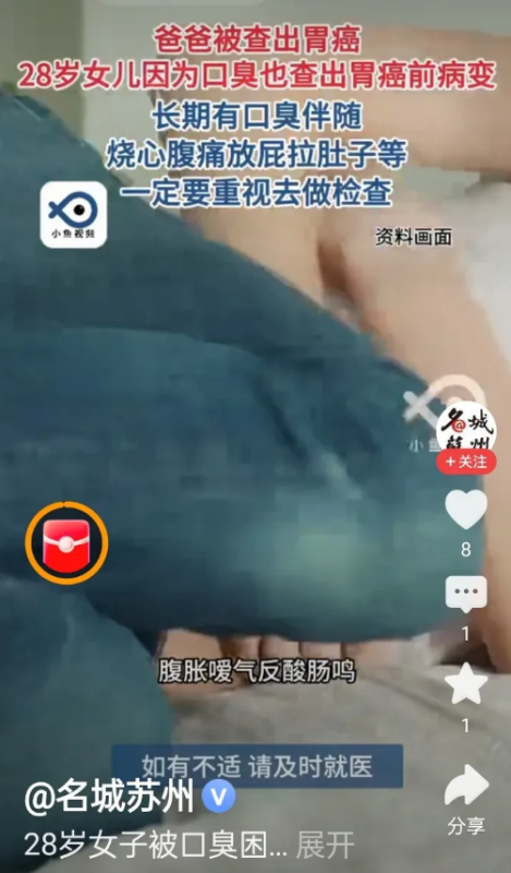经过父亲接受胃癌手术治疗的经历，其女儿随后也被确诊为胃癌前期病变。-阿旺资源分享网